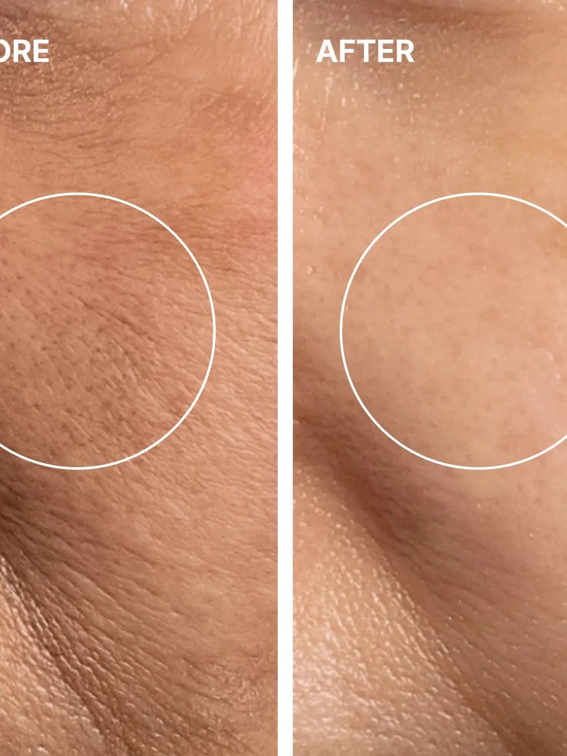 THOME Program Action Mask Kit - 4 Step Home Spa - Song of Skin