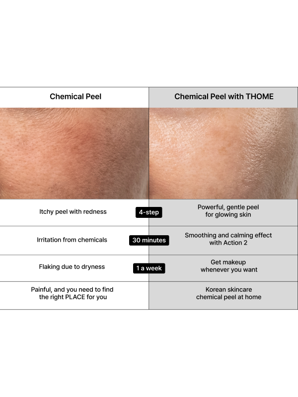 THOME Program Action Mask Kit - 4 Step Home Spa - Song of Skin