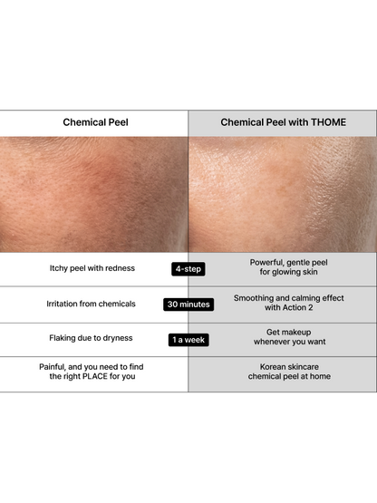 THOME Program Action Mask Kit - 4 Step Home Spa - Song of Skin